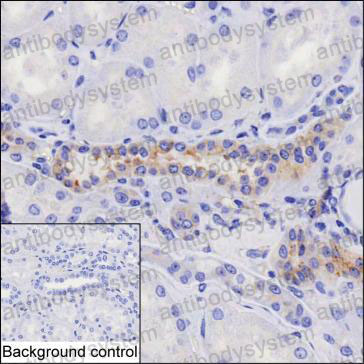Anti-HIP1 Antibody (R2T36)