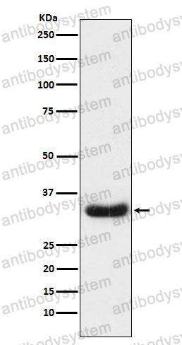 Anti-LEFTY1/2 Antibody (R1C80)