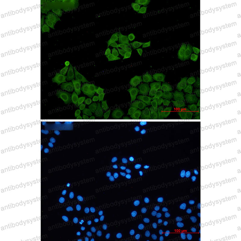 Anti-CLIC1 Antibody (R1C81)