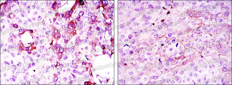 Anti-TNFRSF11B Antibody (R2T38)