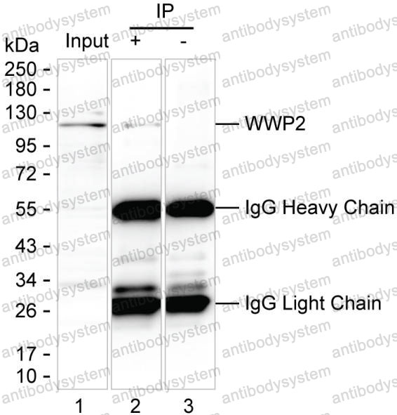 Anti-WWP2 Antibody (R2T39)