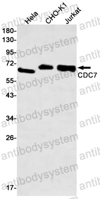Anti-CDC7 Antibody (R1C82)