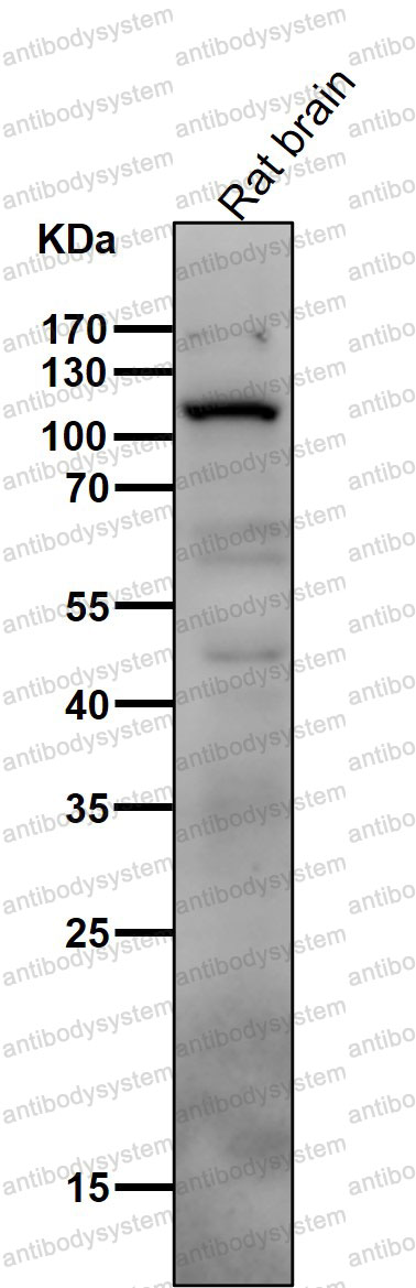 Anti-PIK3CD Antibody (R1C83)
