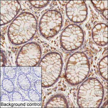 Anti-MATN2 Antibody (R2T41)