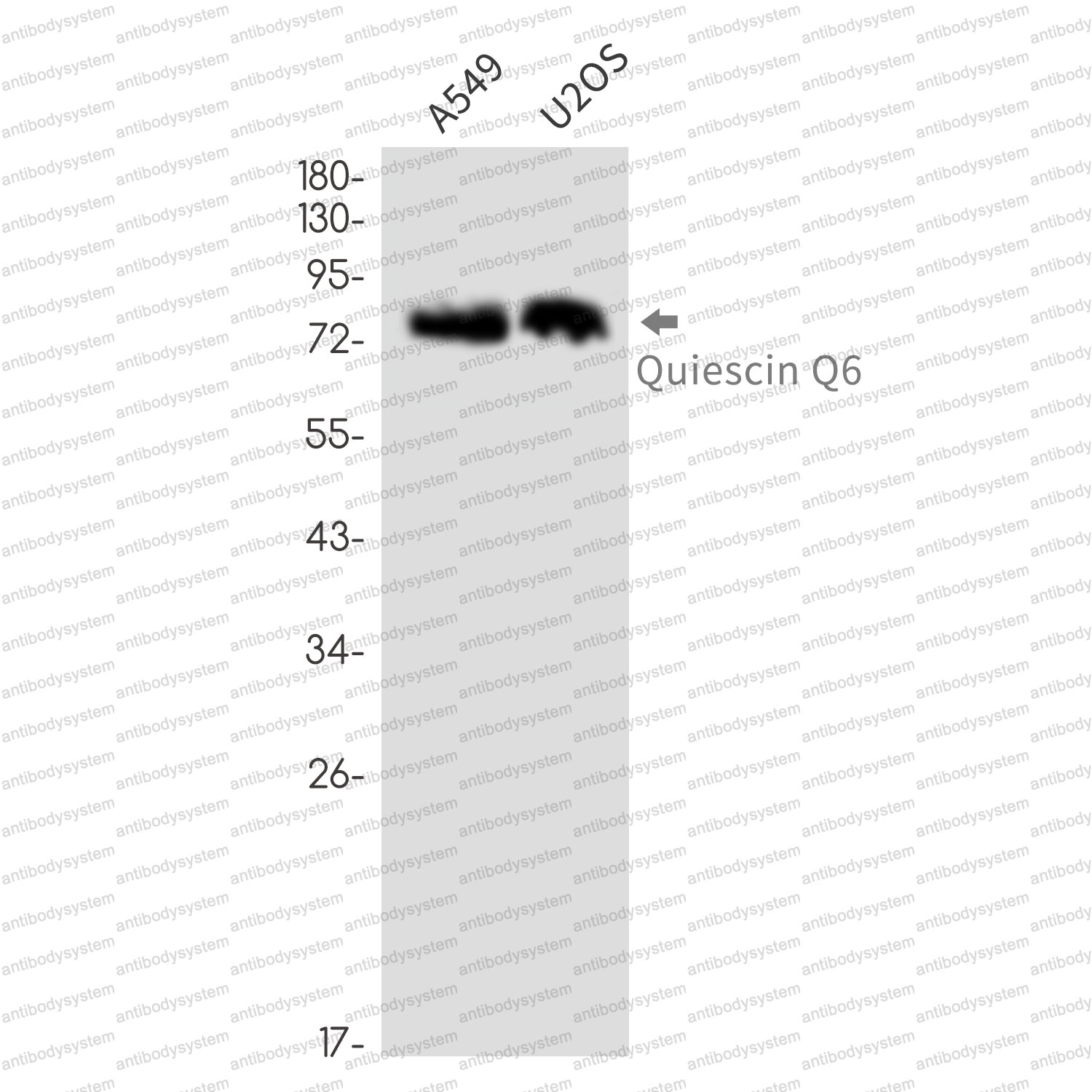 Anti-QSOX1 Antibody (R1C84)