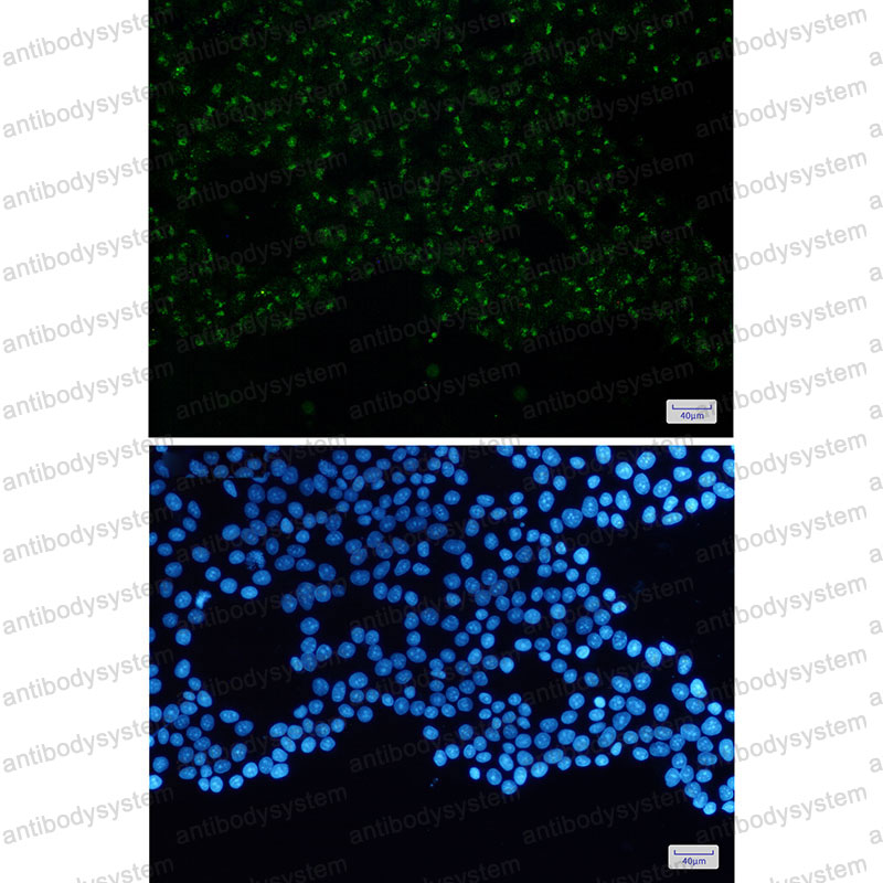 Anti-WASL Antibody (R1C86)