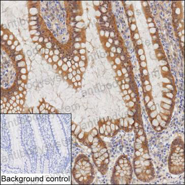 Anti-WASL Antibody (R2T42)
