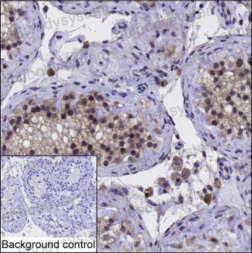 Anti-SAP18 Antibody (R2T43)