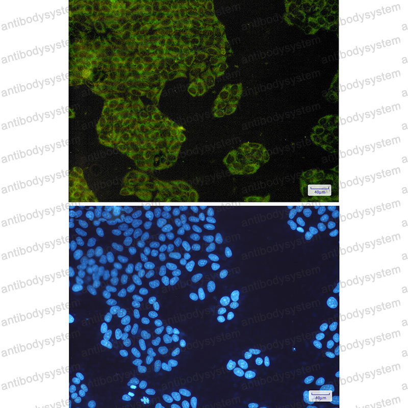 Anti-IGF2BP3/IMP3 Antibody (R1C88)