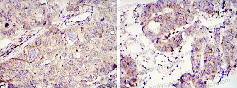 Anti-IGF2BP3 Antibody (R2T44)