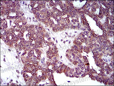 Anti-DRP1/DNM1L Antibody (R2T47)