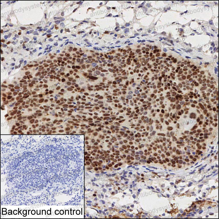 Anti-IFRD1 Antibody (R2T50)