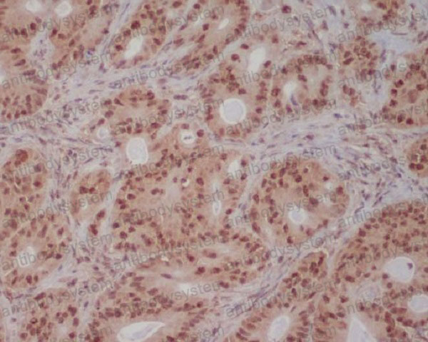Anti-PI3 Kinase p85 beta Antibody (R1C37)