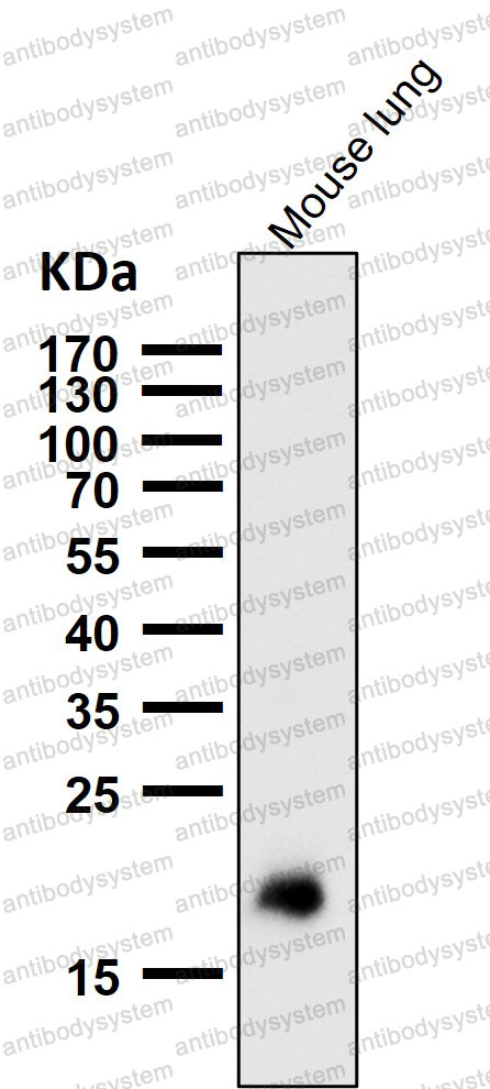 Anti-CLDN5/Claudin-5 Antibody (R1C96)