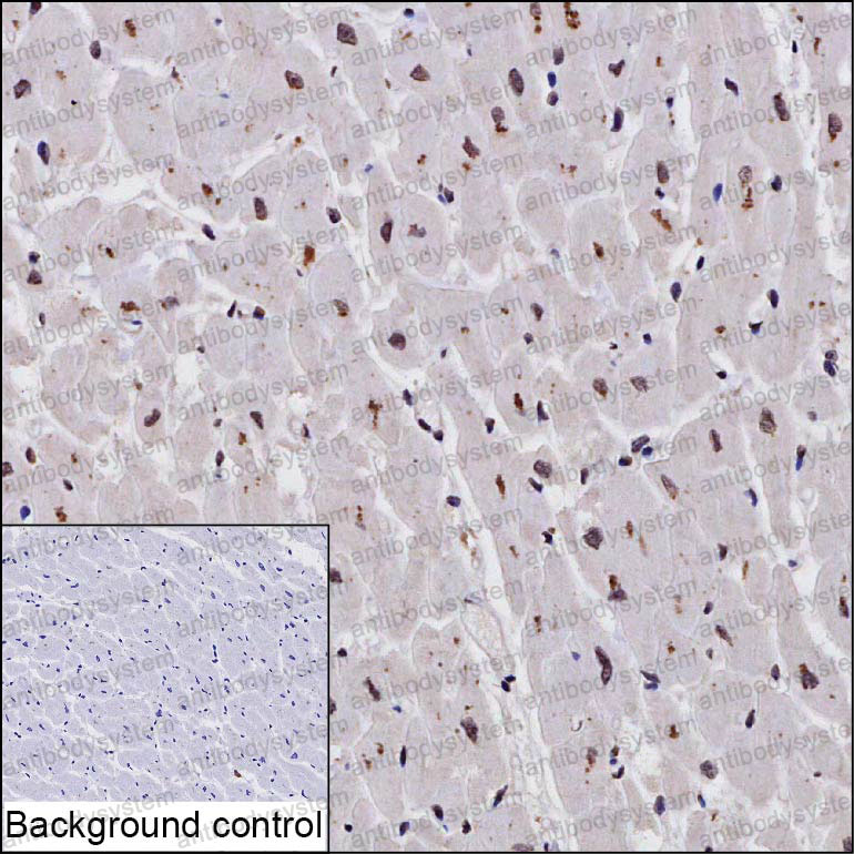 Anti-VWA5A Antibody (R2T53)