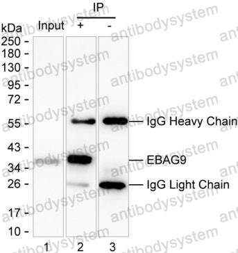 Anti-EBAG9 Antibody (R2T55)