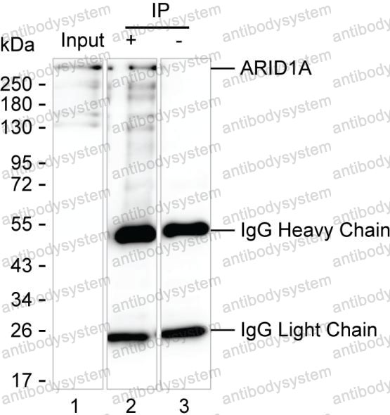 Anti-ARID1A Antibody (R2T70)