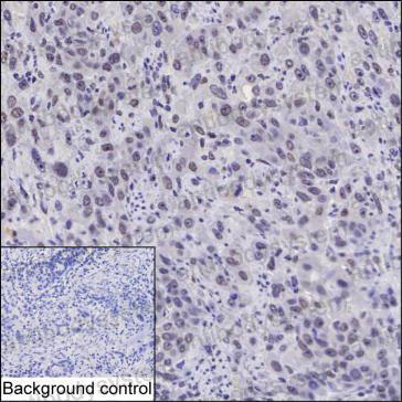 Anti-ARID1A Antibody (R2T69)