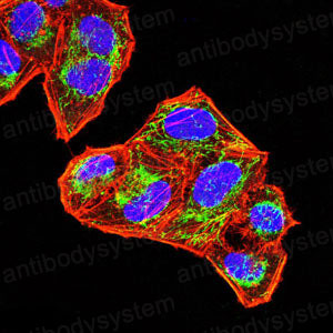 Anti-SOCS3 Antibody (R2T71)