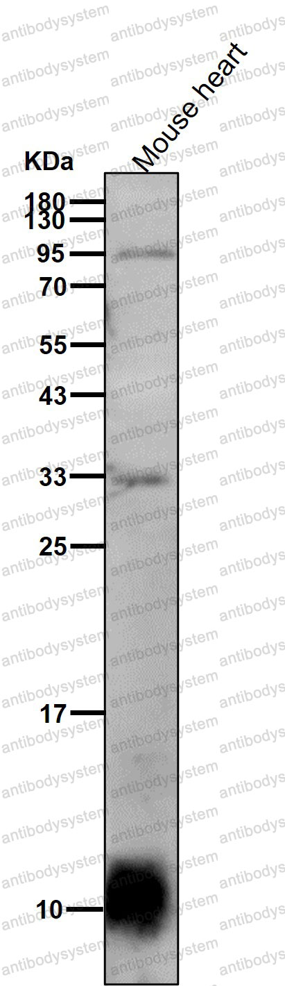 Anti-NDUFAB1 Antibody (R1B44)