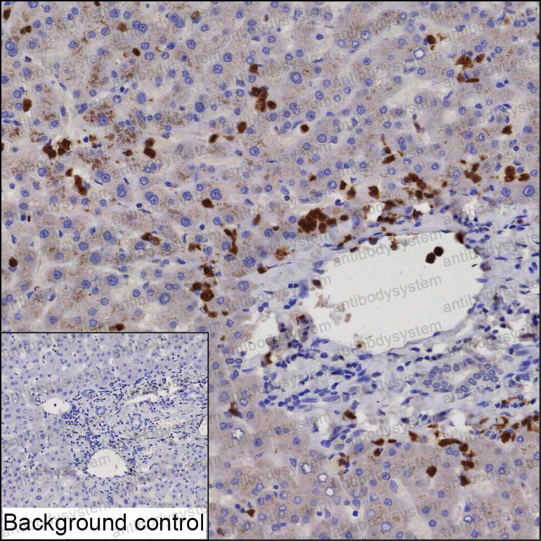 Anti-COPE Antibody (R2T74)