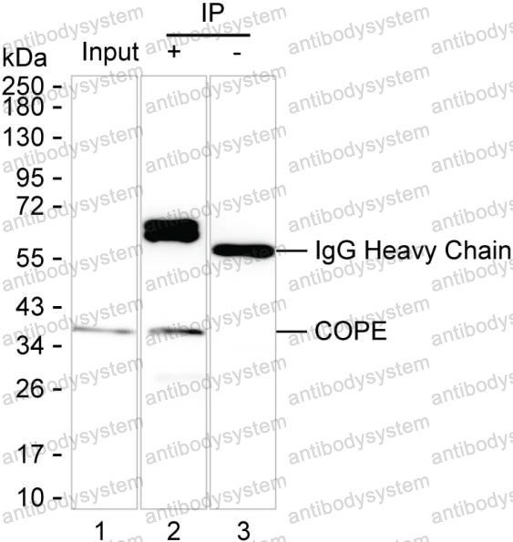 Anti-COPE Antibody (R2T75)