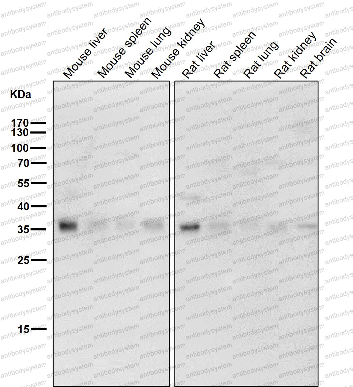 Anti-TOR1A/Torsin-1A/DQ2 Antibody (R1A84)