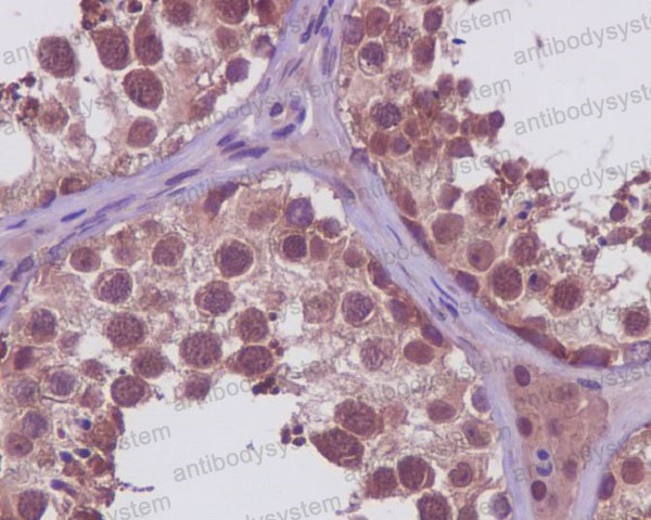 Anti-PRMT5 Antibody (R1B89)