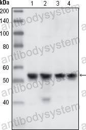 Anti-CHEK1 Antibody (R2T88)