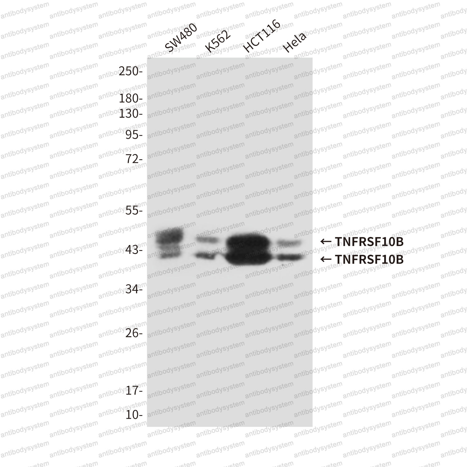 Anti-CD262/TNFRSF10B/TRAIL-R2/DR5 Antibody (R2T89)