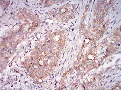 Anti-MSTN/GDF8 Antibody (R2T98)