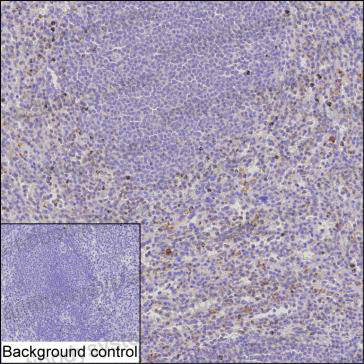 Anti-CD263/TNFRSF10C Antibody (R2U01)