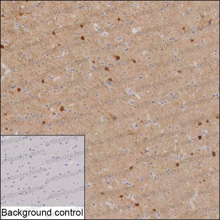 Anti-CPLX1 Antibody (R2U02)