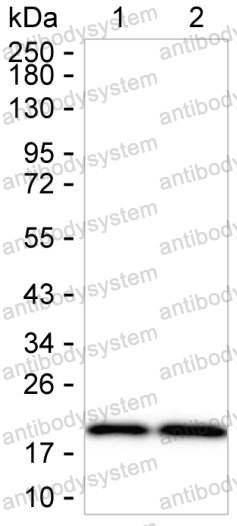 Anti-CPLX1 Antibody (R2U03)