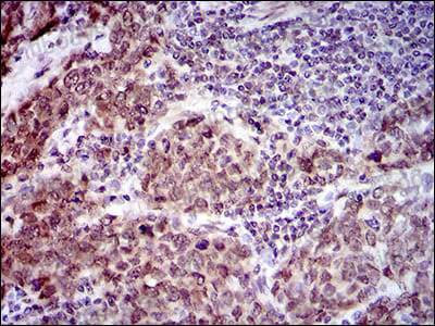 Anti-CLGN/Calmegin Antibody (R2U22)