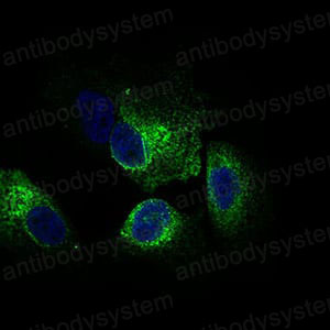 Anti-CLGN/Calmegin Antibody (R2U21)