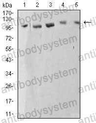 Anti-ATP2A1 Antibody (R2U24)