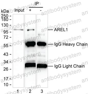 Anti-AREL1 Antibody (R2U28)