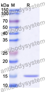 Anti-Human MDM4 Nanobody (SAA1189)