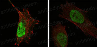 Anti-MDM4 Antibody (R2U42)