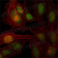 Anti-ZBTB7B Antibody (R2U43)