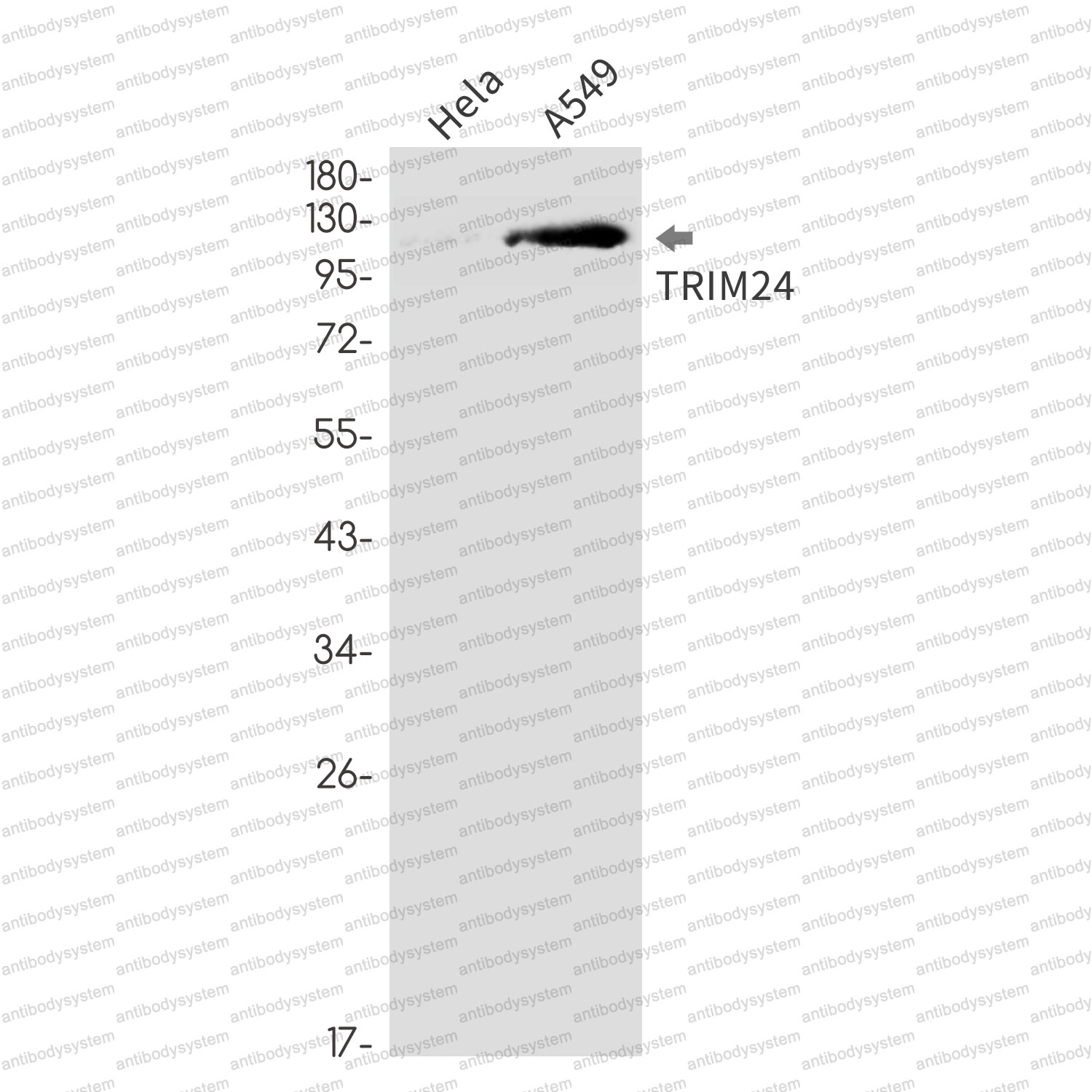 Anti-TRIM24 Antibody (R1D63)
