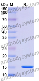 Anti-Human EPHB6 Nanobody (SAA1264)