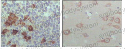 Anti-EPHB6 Antibody (R2U48)