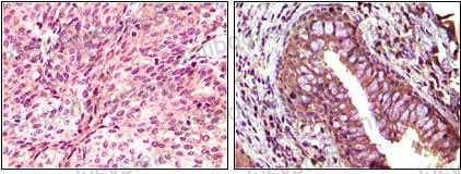 Anti-EPHB6 Antibody (R2U47)