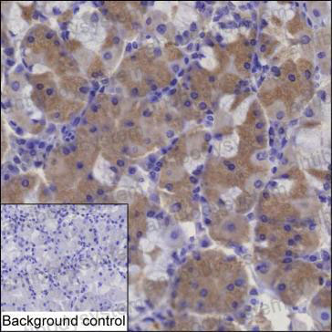 Anti-RGL2 Antibody (R2U49)