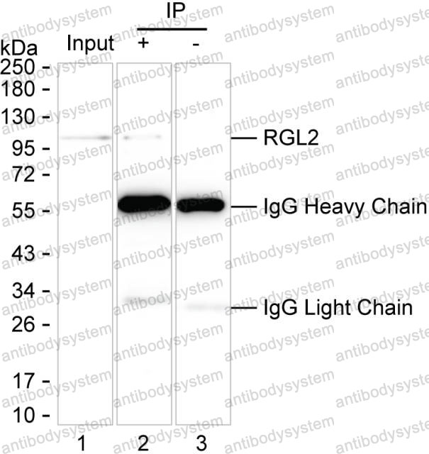 Anti-RGL2 Antibody (R2U50)