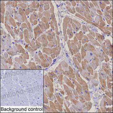 Anti-TCAP Antibody (R2U52)