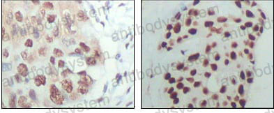 Anti-HDAC3 Antibody (R2U55)