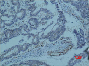 Anti-BIRC5 Antibody (R2U59)